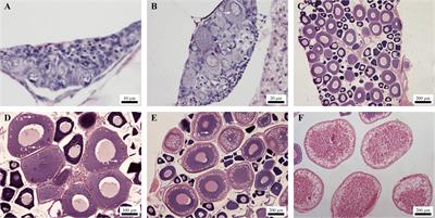 Integrated transcriptomic and metabolomic analyses identify key factors in the vitellogenesis of juvenile Sichuan bream (Sinibrama taeniatus)